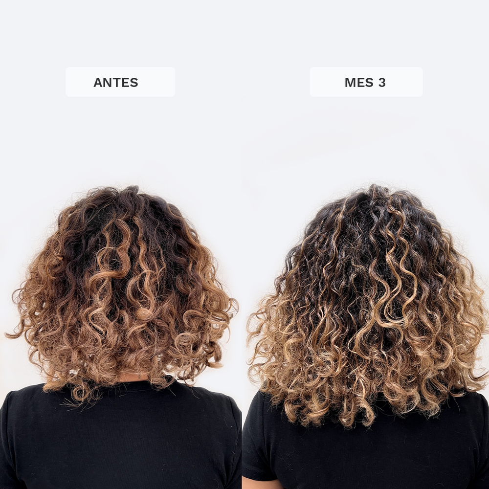 Dúo Reset Capilar Vegano